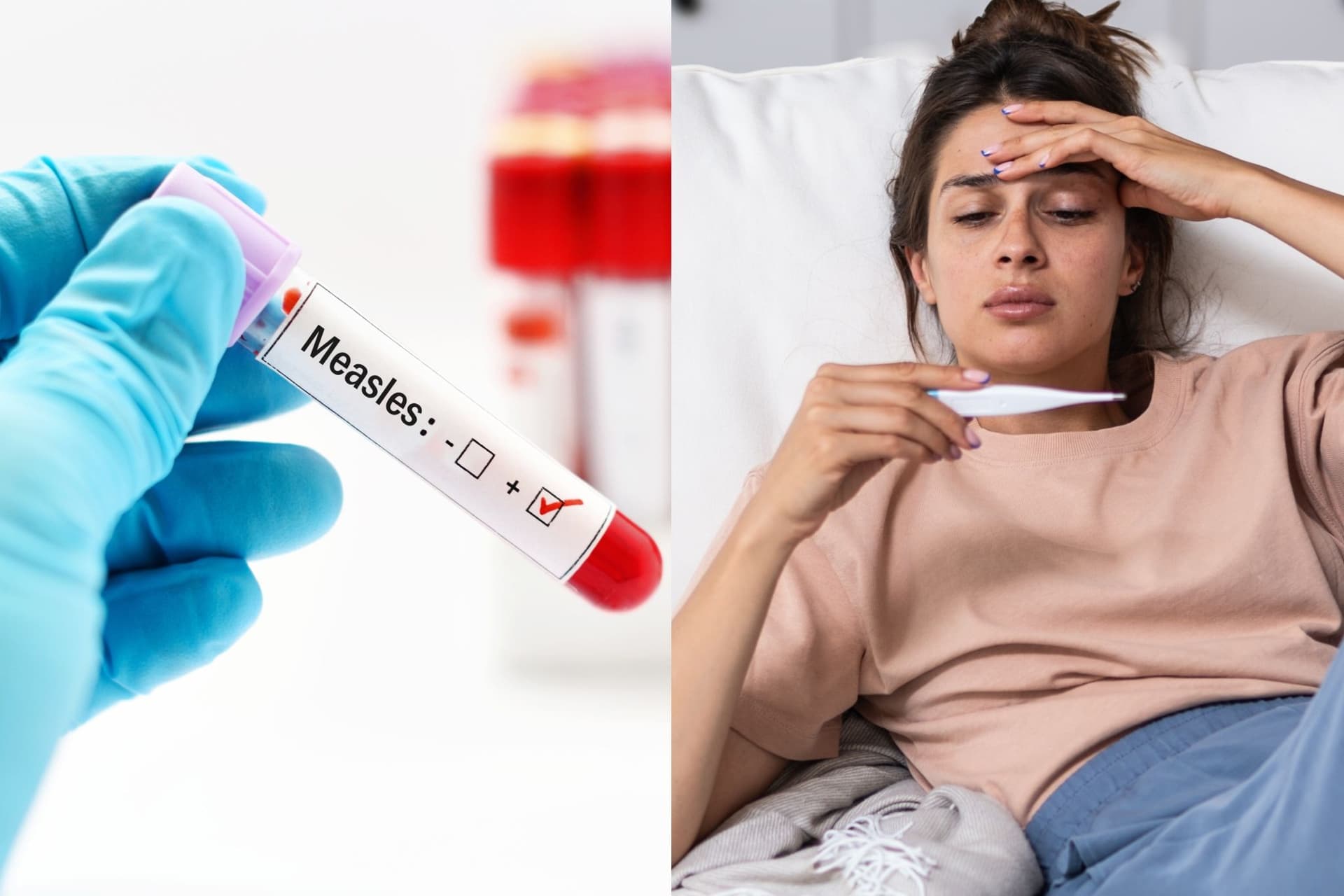 https://display.dailyhive.com/uploads/2025/10/measles-symptoms-1.jpg